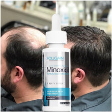 Carregar imagem no visualizador da galeria, Spray de soro de crescimento de cabelo crescimento de cabelo líquido tratamento de crescimento de cabelo folículo capilar anti queda de cabelo beleza natural saúde cuidados com o cabelo
