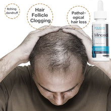 Carregar imagem no visualizador da galeria, Spray de soro de crescimento de cabelo crescimento de cabelo líquido tratamento de crescimento de cabelo folículo capilar anti queda de cabelo beleza natural saúde cuidados com o cabelo
